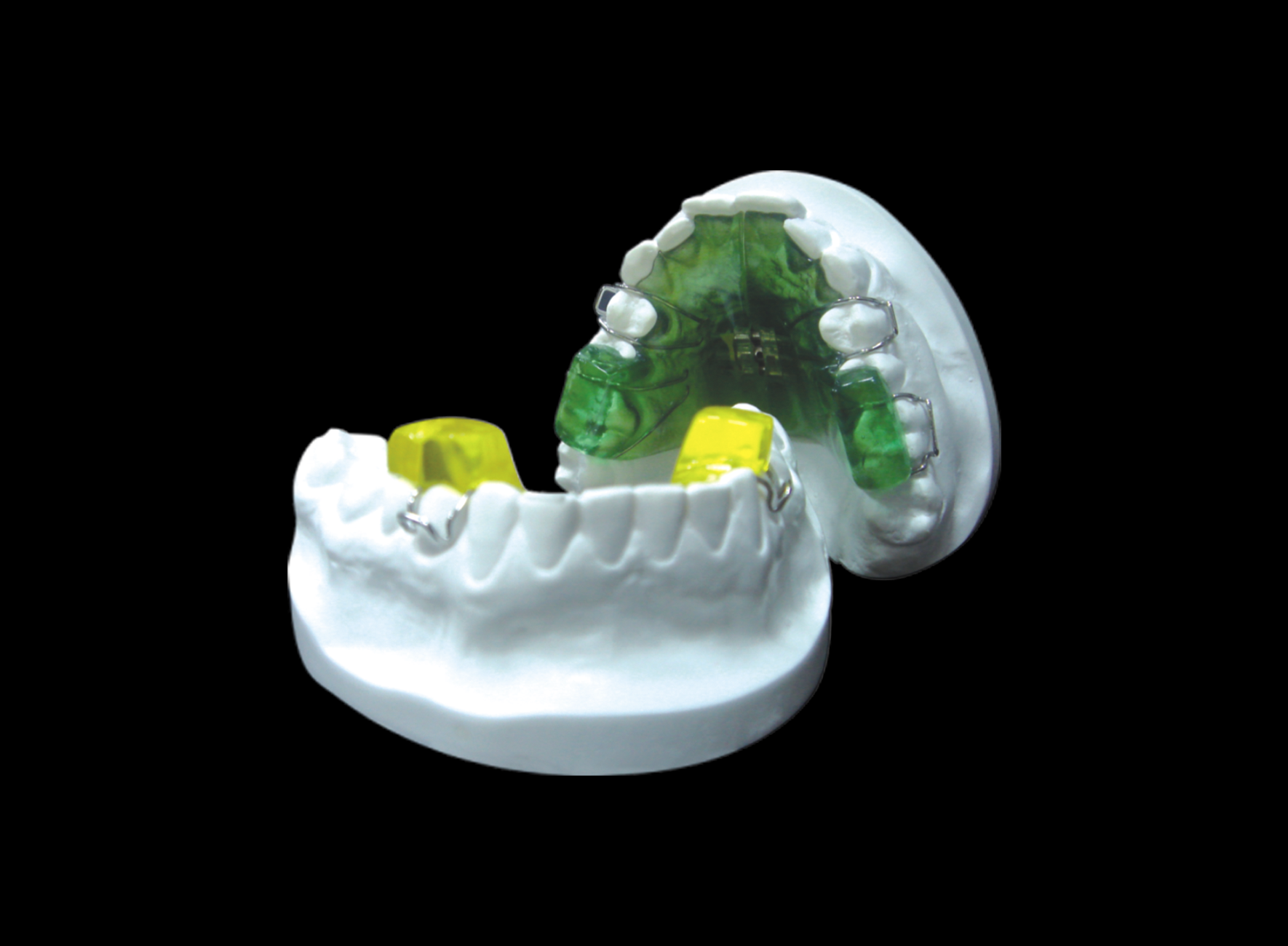 牙齿矫正时保持器使用应注意什么——广州德伦口腔